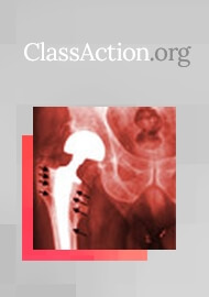 While US Lawsuits Mount, United Kingdom Bans Metal-on-Metal Hip Implants